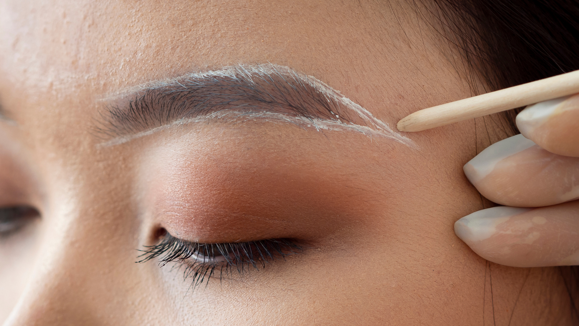 Eyebrows Transplantation