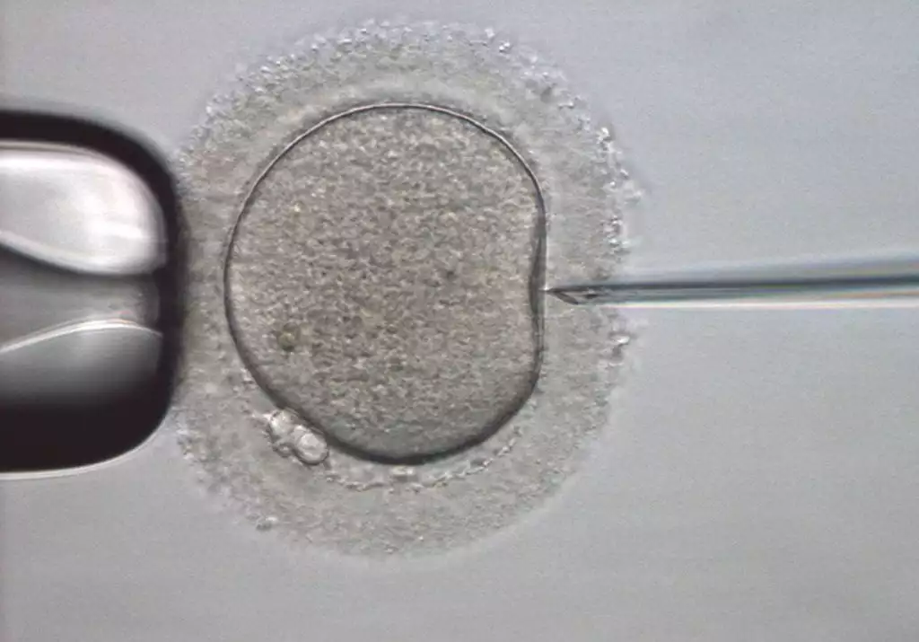IVF/ICSI