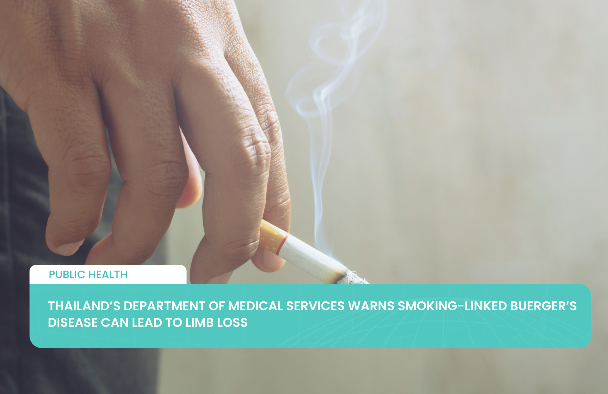 Thailand’s Department of Medical Services Warns Smoking-Linked Buerger’s Disease Can Lead to Limb Loss