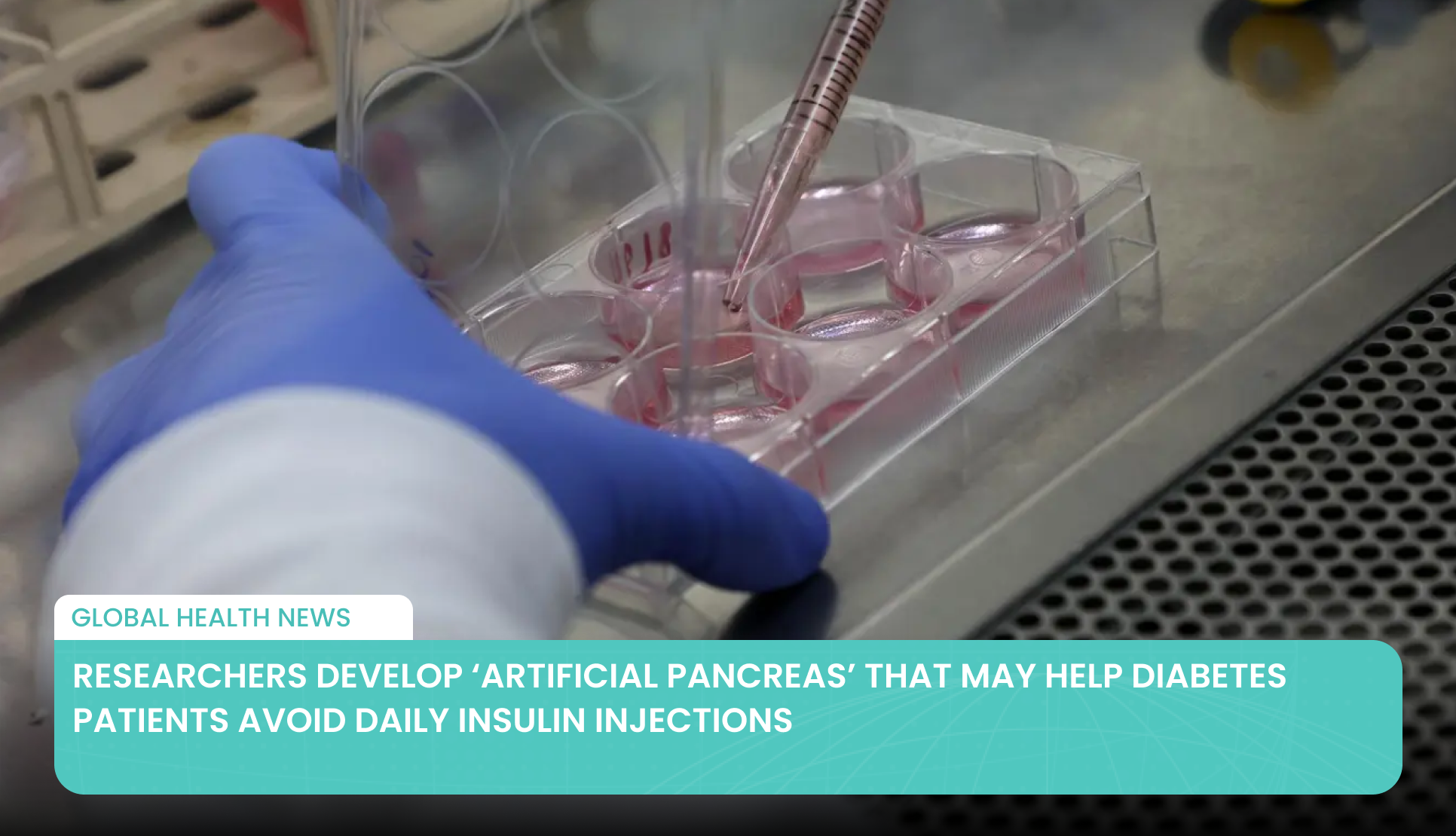 Researchers Develop ‘Artificial Pancreas’ That May Help Diabetes Patients Avoid Daily Insulin Injections