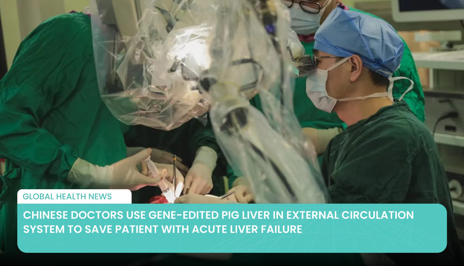 Chinese Doctors Use Gene-Edited Pig Liver in External Circulation System to Save Patient with Acute Liver Failure