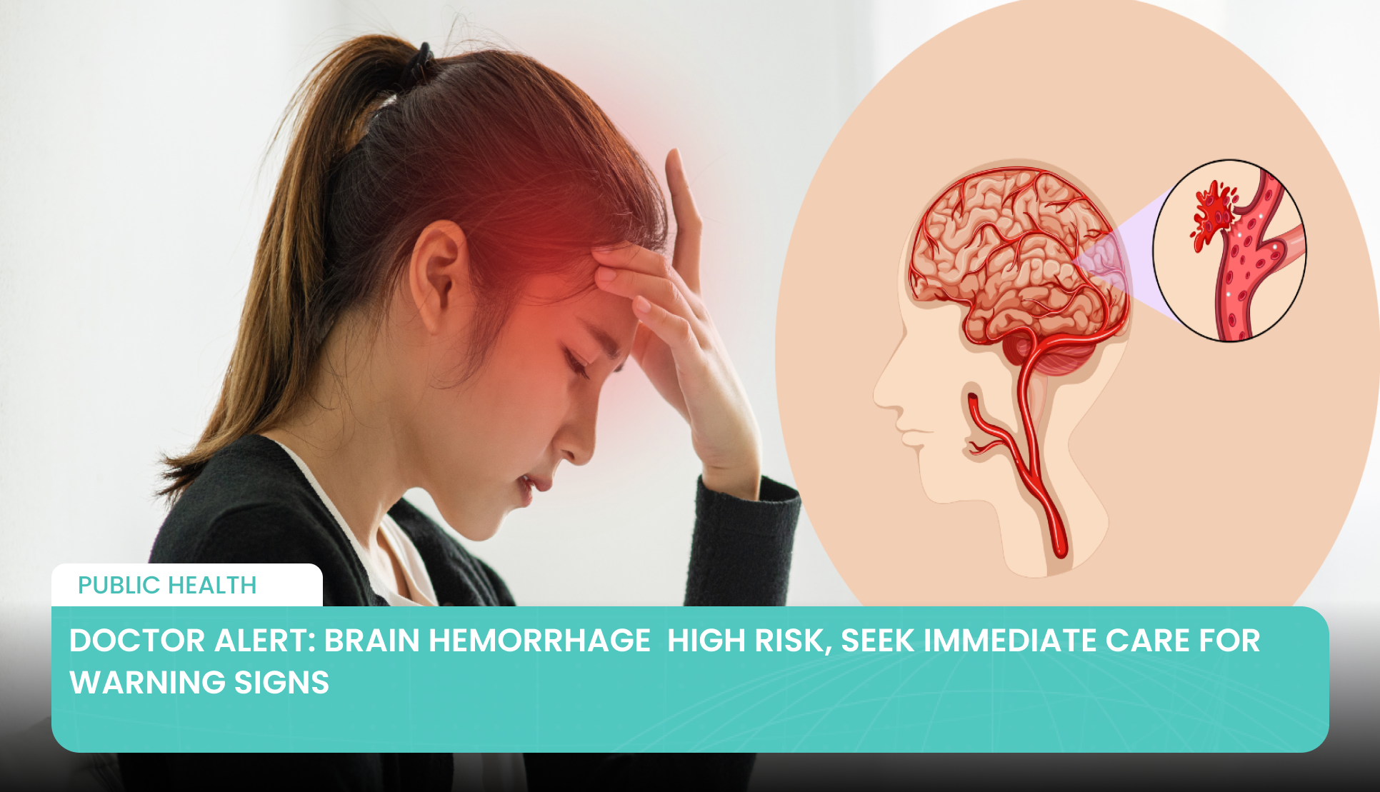 Doctor Alert: Brain Hemorrhage  High Risk, Seek Immediate Care for Warning Signs