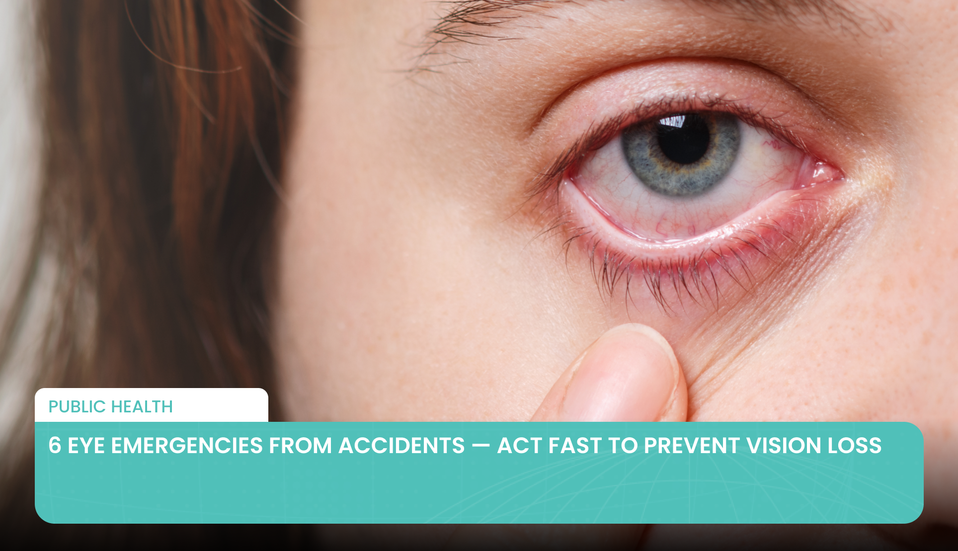 6 Eye Emergencies from Accidents — Act Fast to Prevent Vision Loss