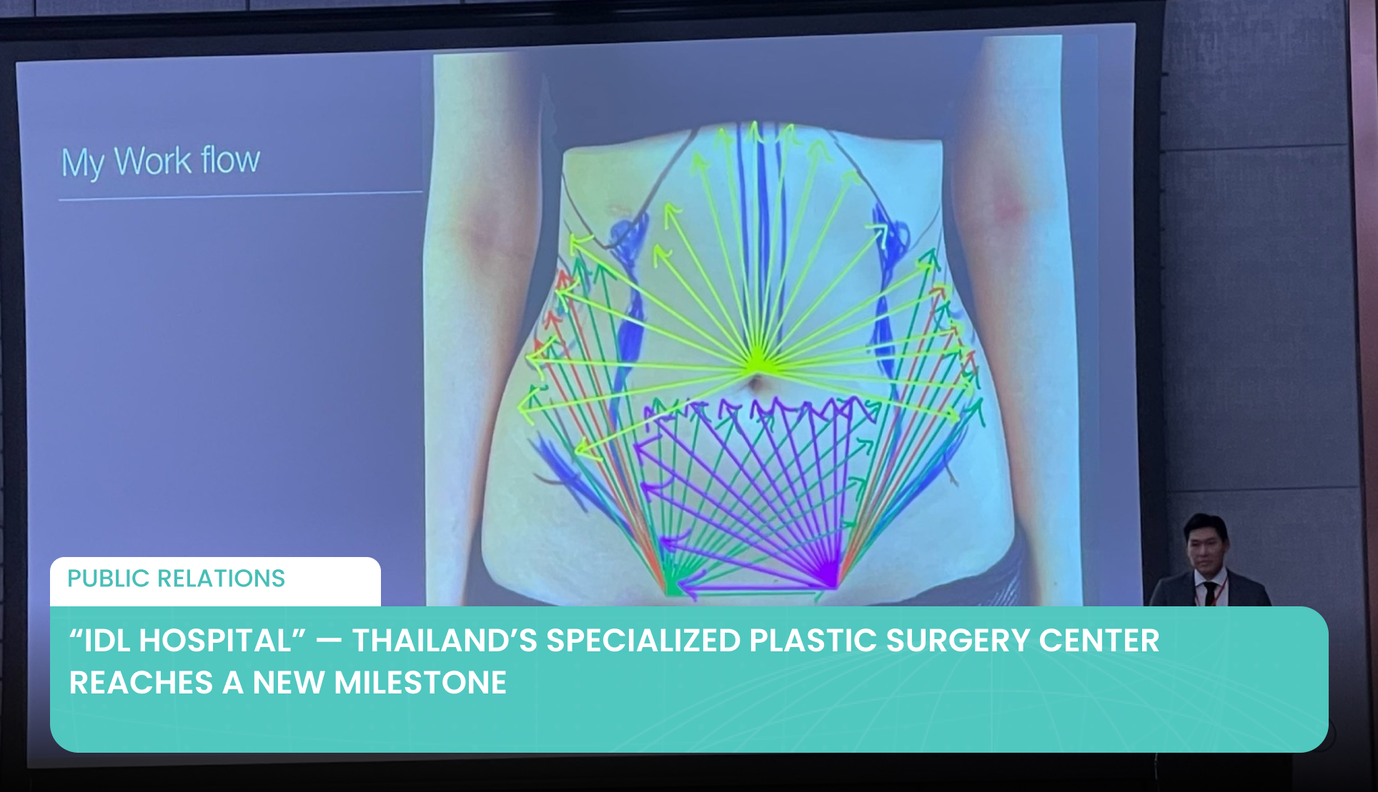 “IDL Hospital” — Thailand’s Specialized Plastic Surgery Center Reaches a New Milestone