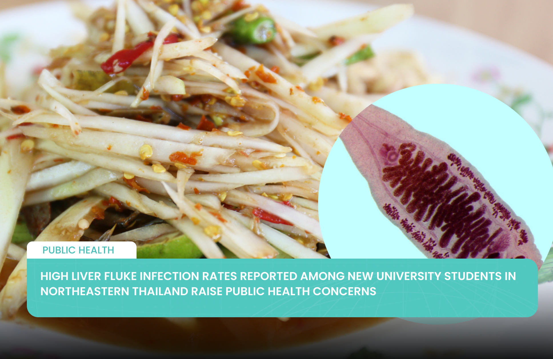 High Liver Fluke Infection Rates Reported Among New University Students in Northeastern Thailand Raise Public Health Concerns