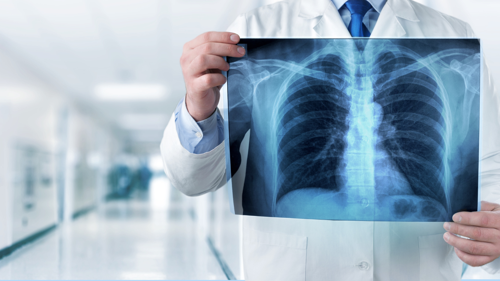 5 traitements pour arrêter le cancer du poumon avant qu'il ne se propage