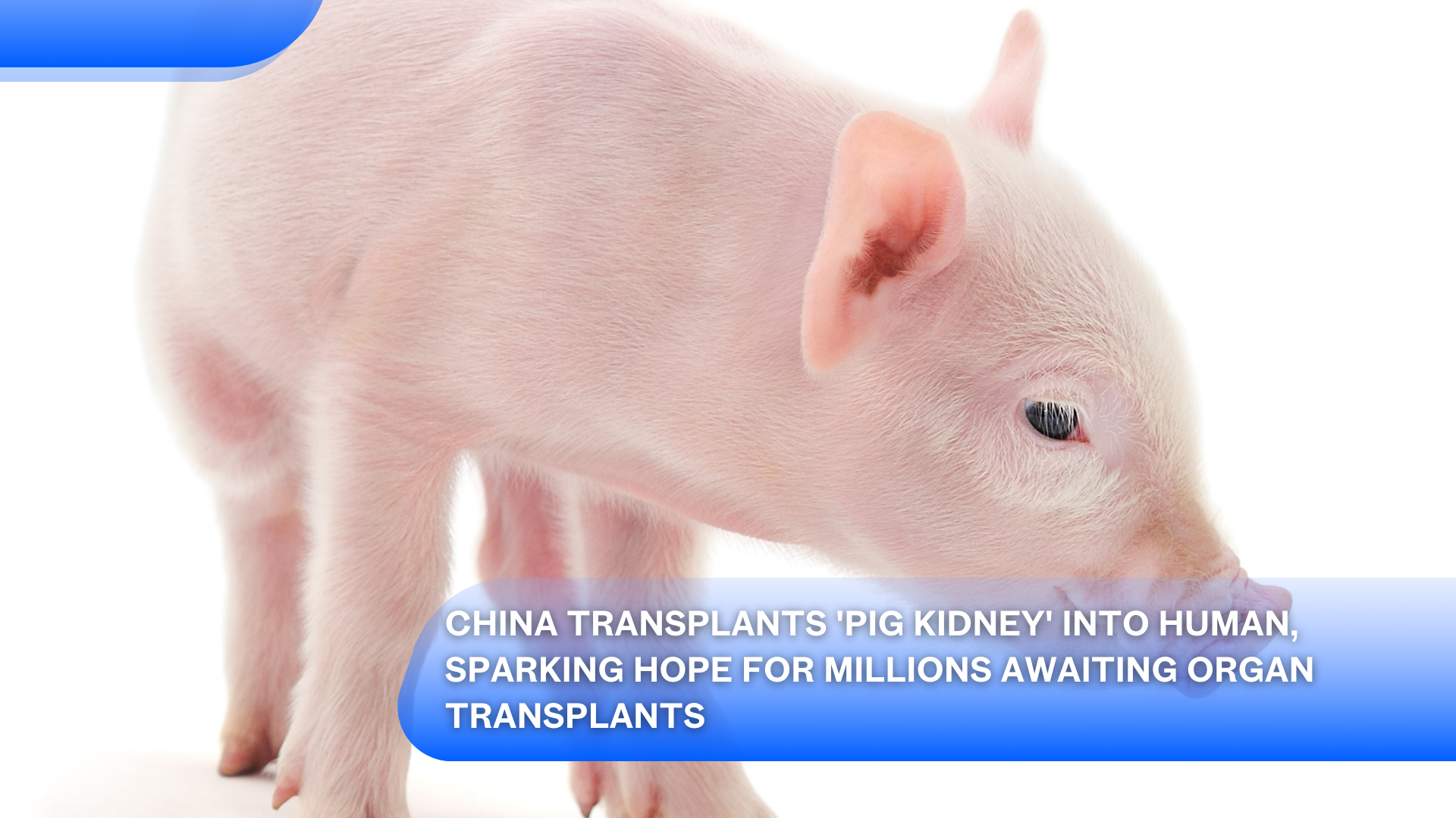 China Transplants 'Pig Kidney' into Human, Sparking Hope for Millions Awaiting Organ Transplants