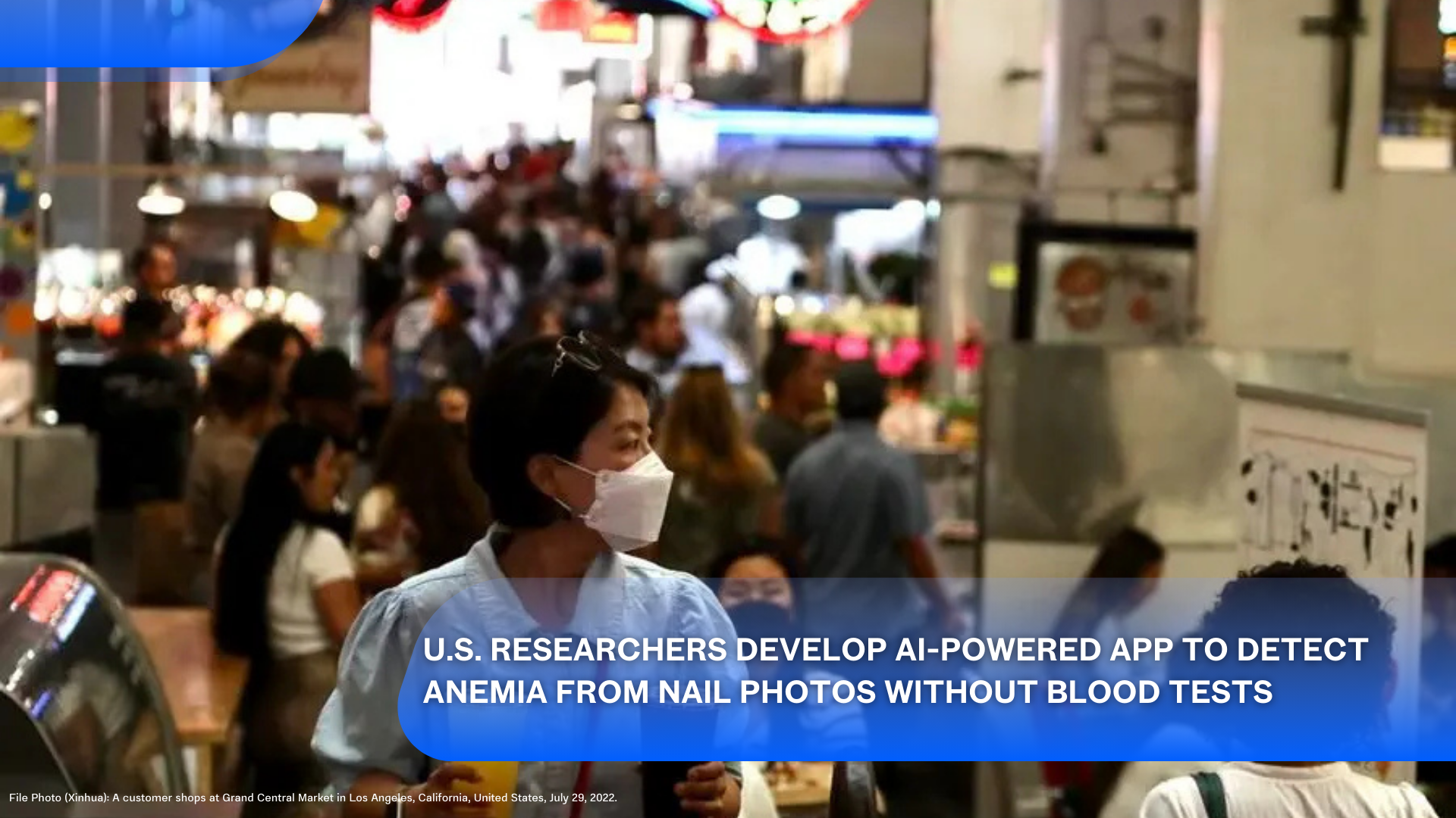 U.S. Researchers Develop AI-Powered App to Detect Anemia from Nail Photos Without Blood Tests