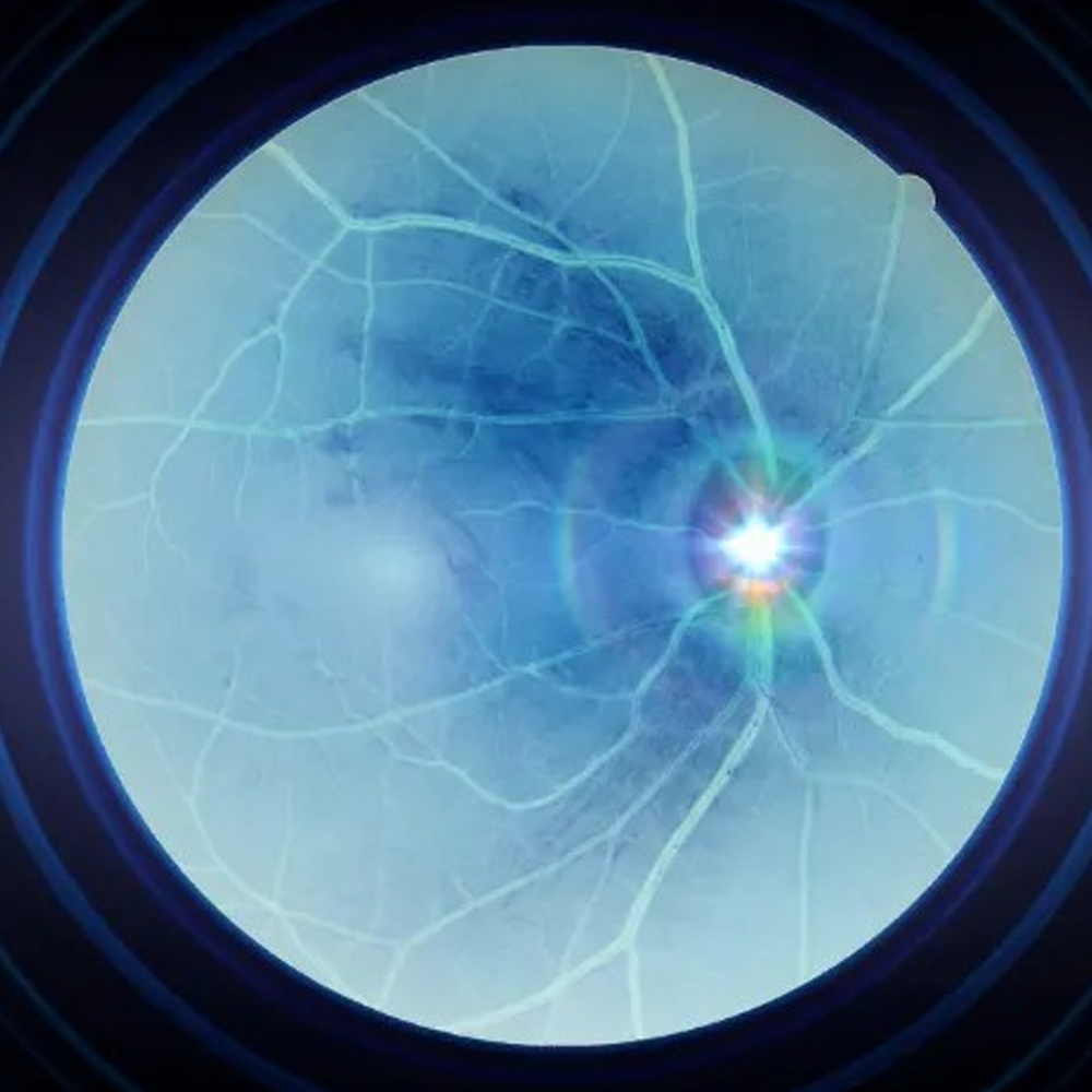 Retina Center