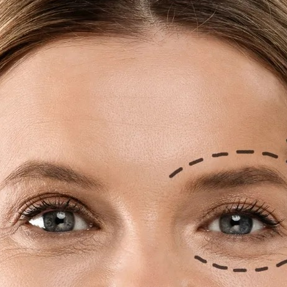 Oculoplastic Center