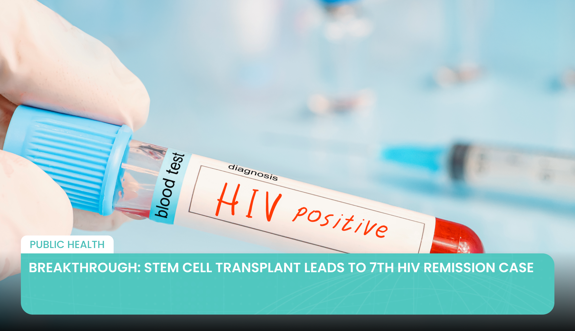 Breakthrough: Stem Cell Transplant Leads to 7th HIV Remission Case