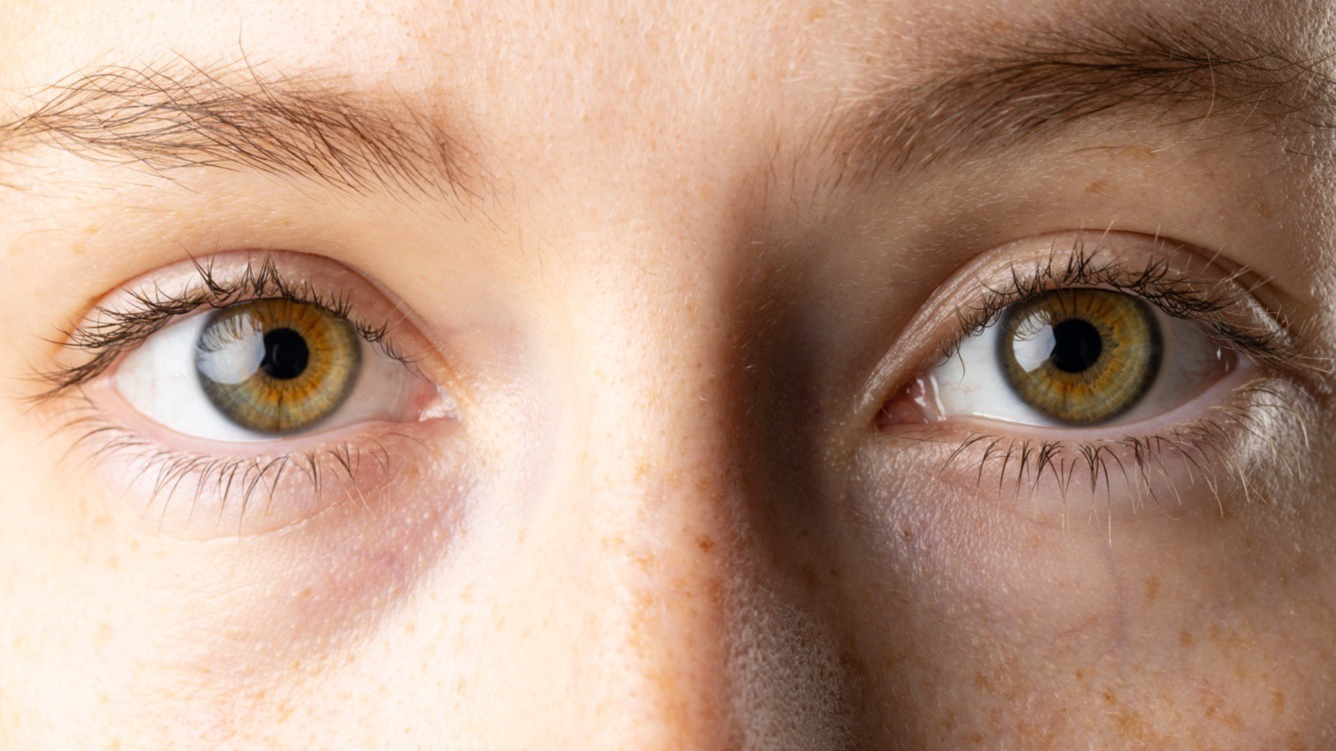 Can Eye Color Really Reveal Disease?