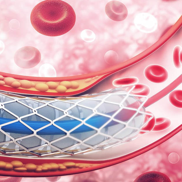 عيادة إعادة التأهيل القلبي