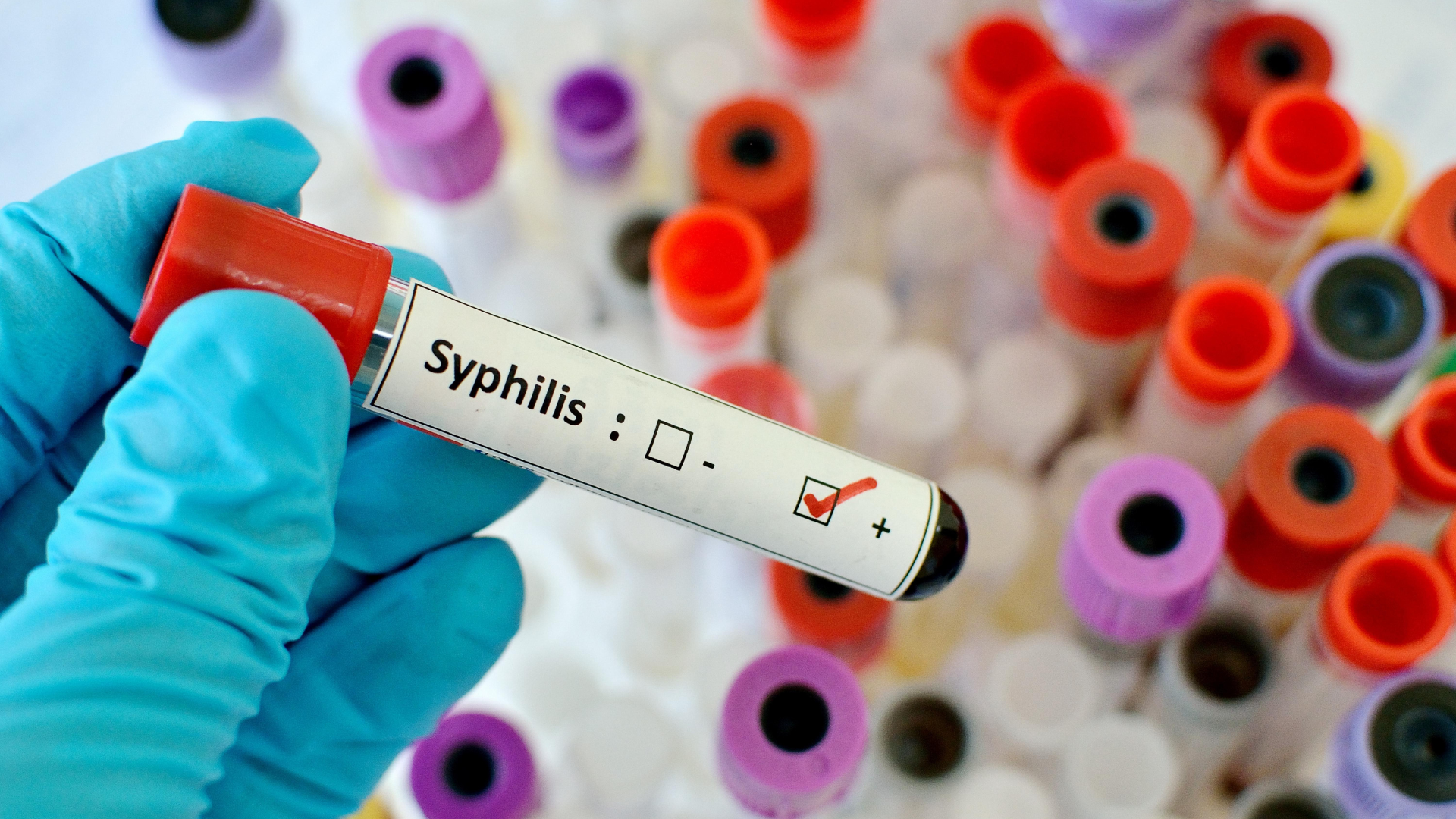 Tokyo Sees Record Surge in Syphilis Cases