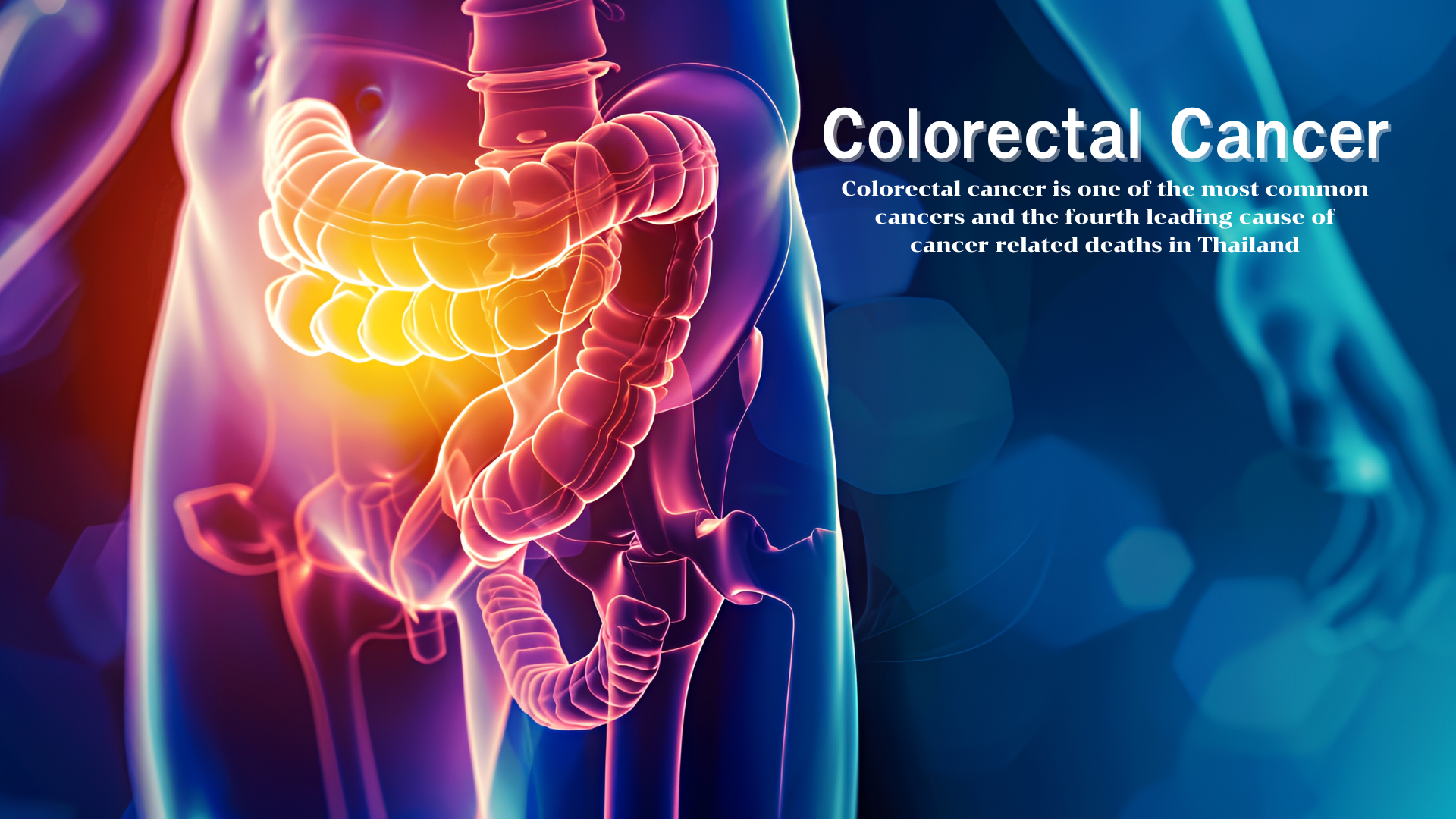 Colorectal Cancer Screening