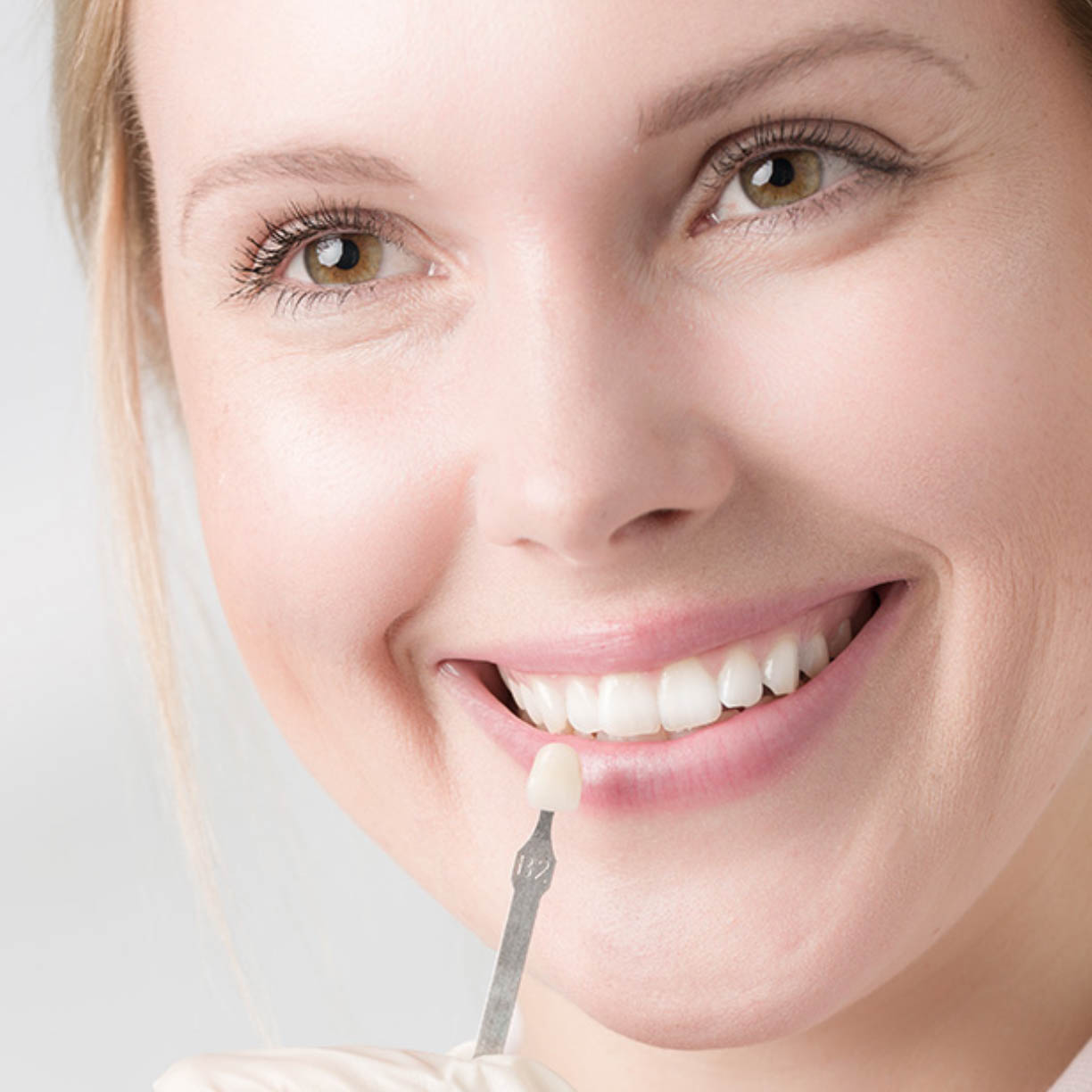 تصميم الابتسامة الرقمية (DSD)