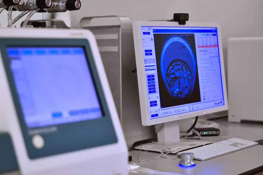 Embryoscope