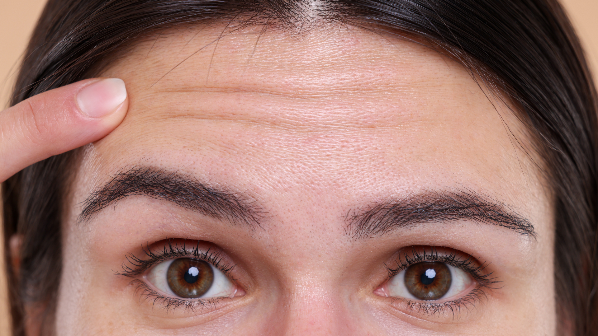 Forehead Lift Surgery