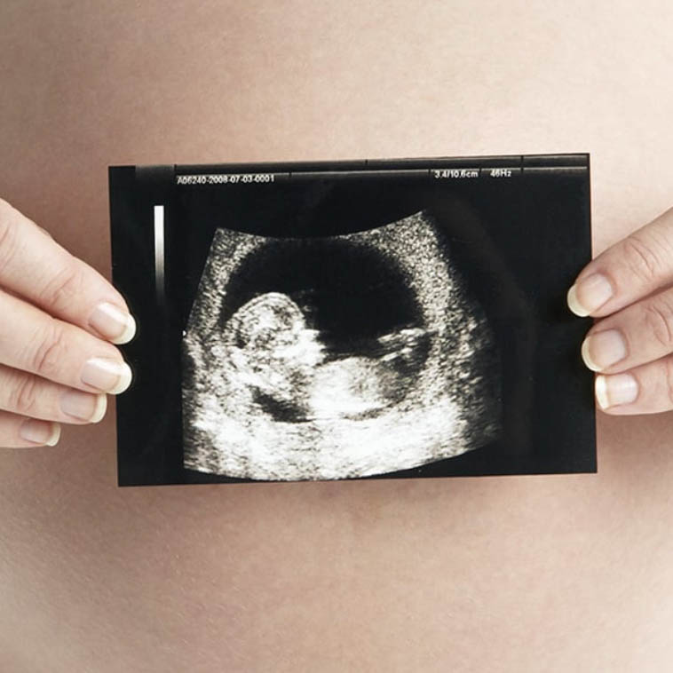 مركز الخصوبة