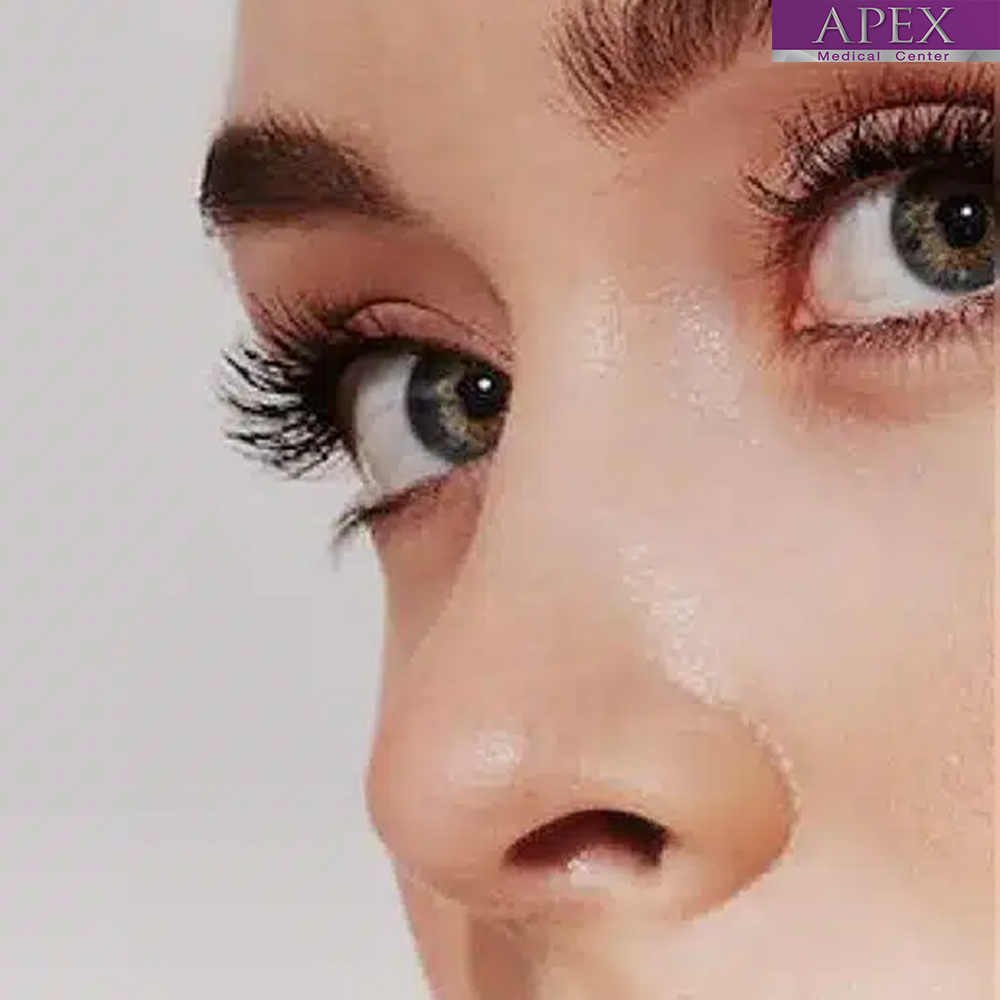Filler Threads: The Next Evolution in Non-Surgical Facial Rejuvenation