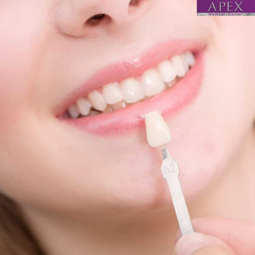 HOLLYWOOD SMILE: Transform Damaged Teeth into a Radiant Smile
