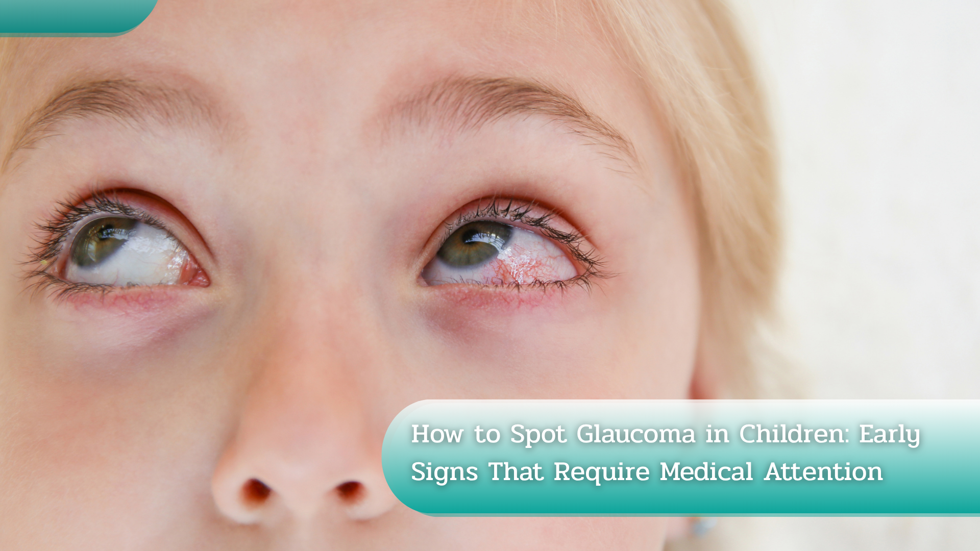 How to Spot Glaucoma in Children: Early Signs That Require Medical Attention