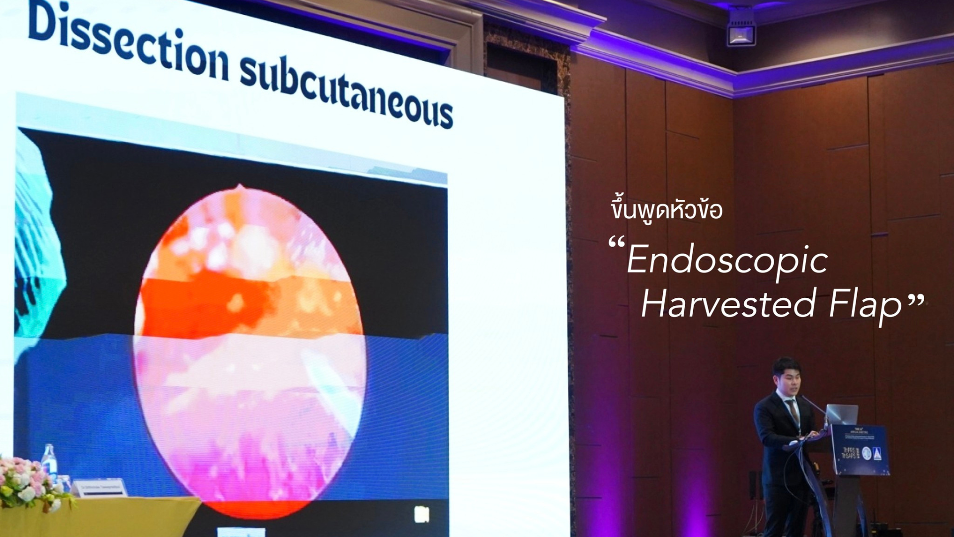 Dr.Bhakabhob of IDL Hospital Presents at ThPRS and ThSAPPS 2024 on Endoscopic Harvested Flap