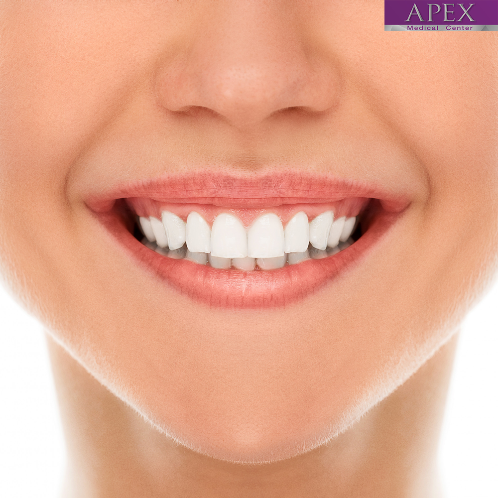 Repair Chipped, Cracked, or Gapped Teeth with Cosmetic Dental Veneers