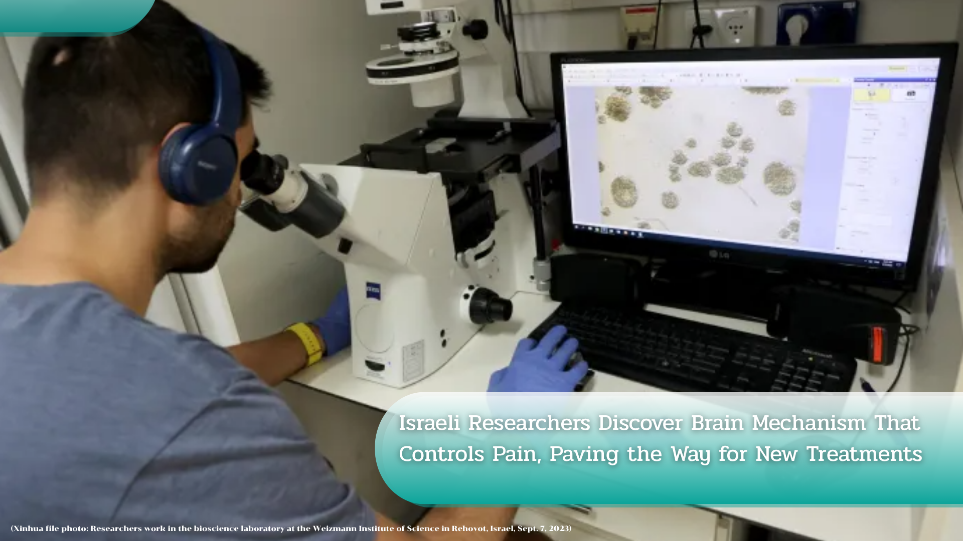 Israeli Researchers Discover Brain Mechanism That Controls Pain, Paving the Way for New Treatments