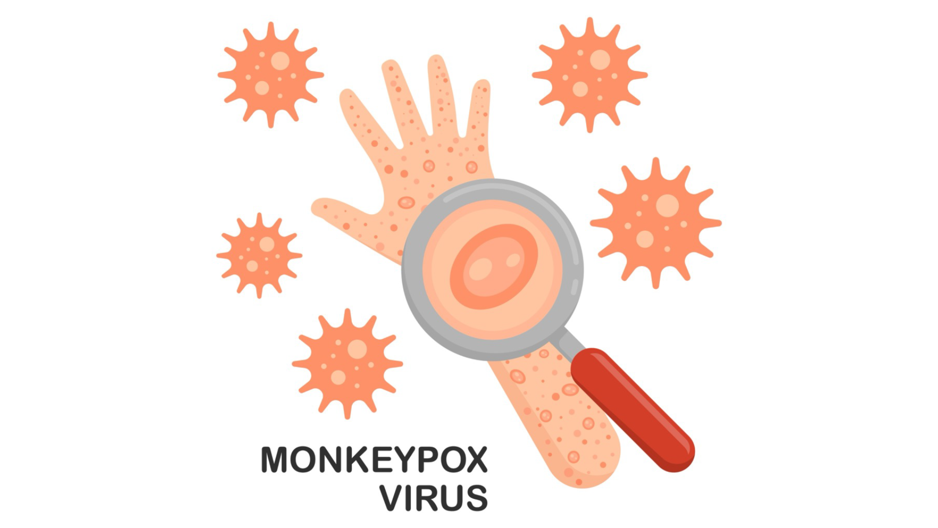 “Varíola dos Macacos” Surge como uma Ameaça Global com Mais de 450 Mortes