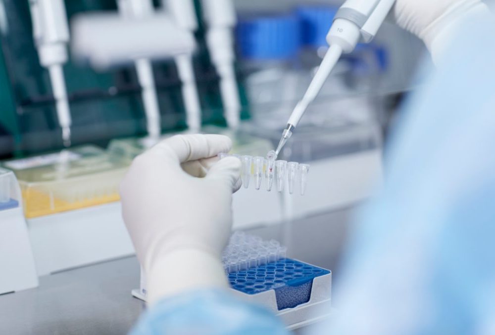 Next Generation Sequencing (NGS)