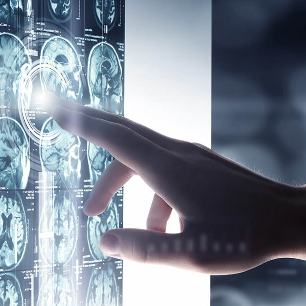 قسم جراحة الأعصاب