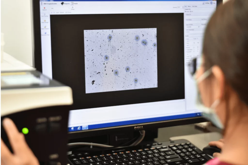 Sperm DNA Fragmentation