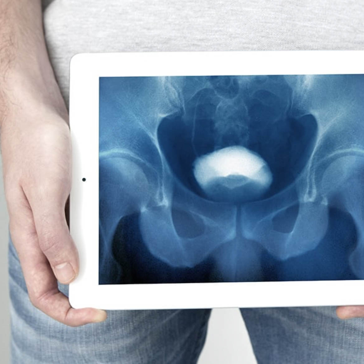 مركز المسالك البولية