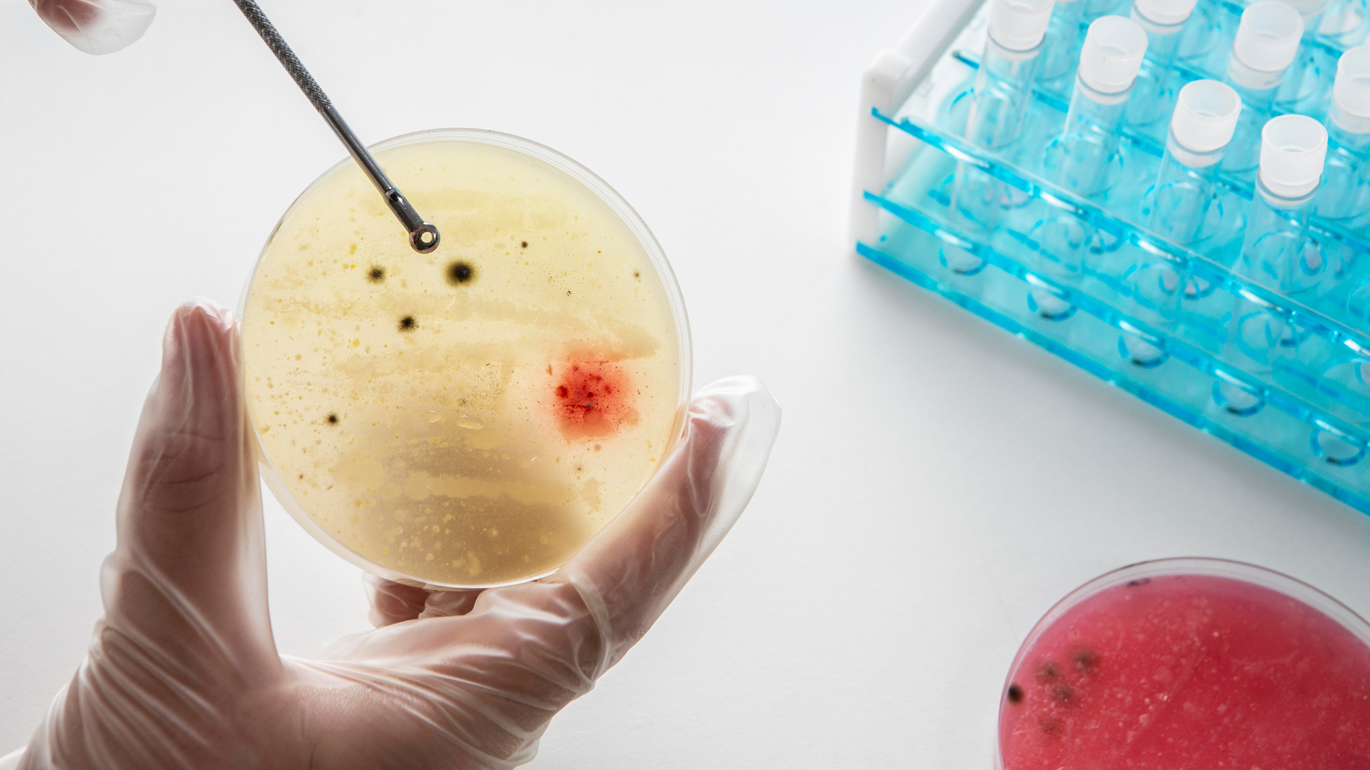 Research predicts global cancer death toll will nearly double by 2050