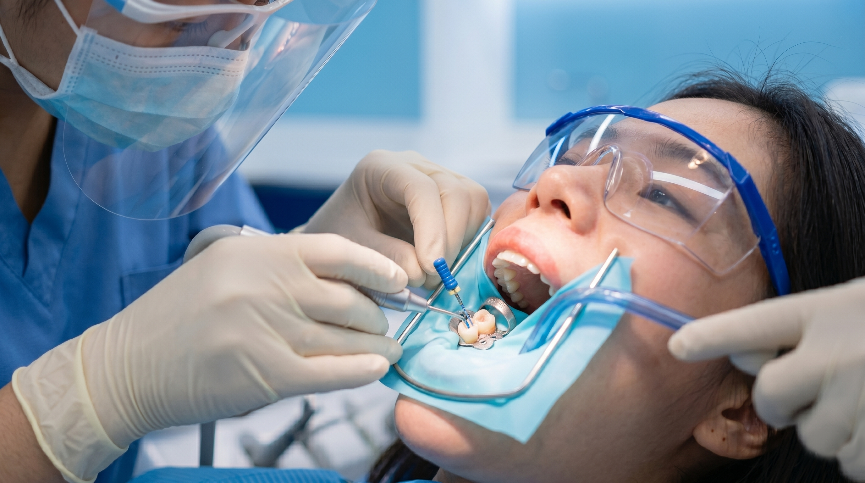 Root Canal Treatment