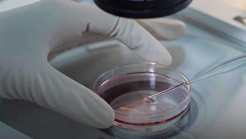 Oocyte Retrieval