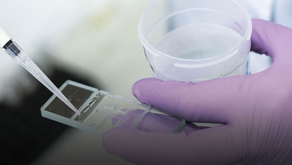 Surgical Sperm Retrieval: PESA & TESE