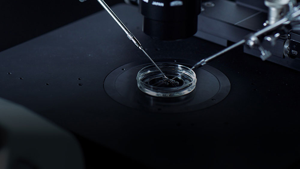  IVF (In Vitro Fertilization).